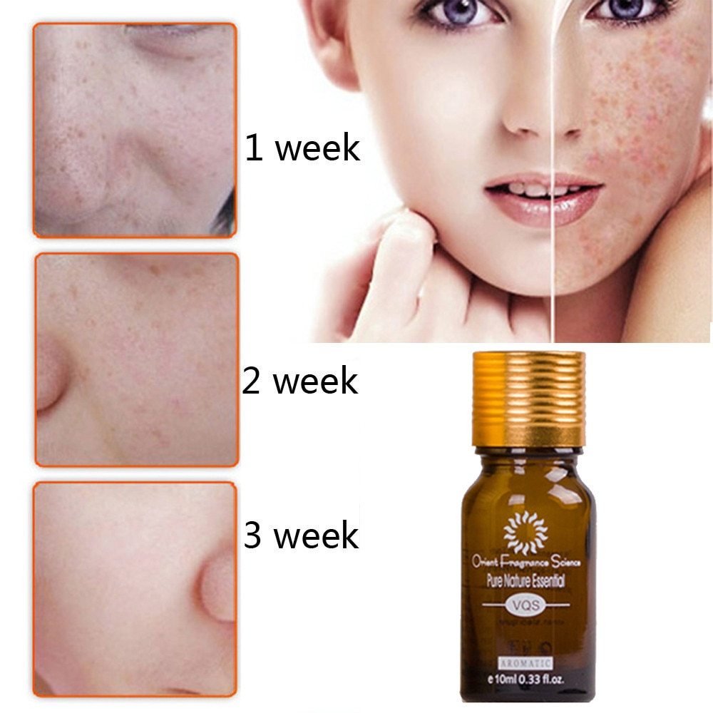 Dredge Meridian Skin Care Natural Pure Removal Acne Stretch Marks Scar Removal Essence oil Dredge Meridian Skin Care Natural Pure Removal Acne Stretch Marks Scar Removal Essence oil